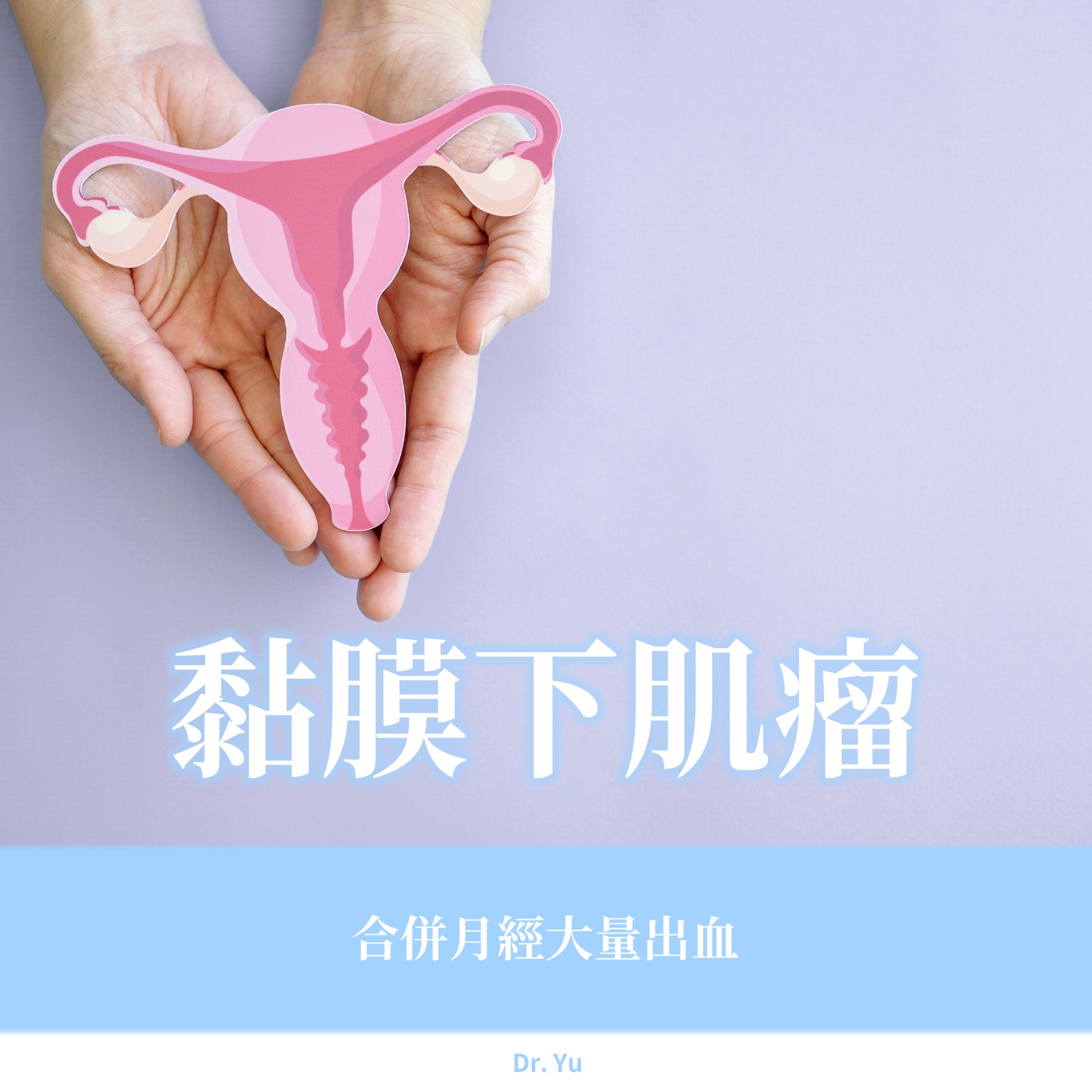 27歲的她，月經量一直很多，原來子宮裡藏著3顆肌瘤｜游正暐醫師